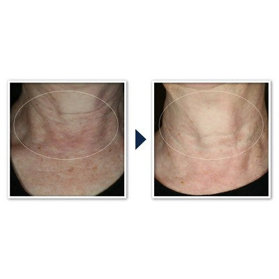 RoC Face & Neck Anti-Aging Moisturizer Firming Cream for Crepey Skin 1.7 fl oz - Imperfect Box