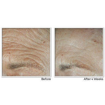 RoC Face & Neck Anti-Aging Moisturizer Firming Cream for Crepey Skin 1.7 fl oz - Imperfect Box
