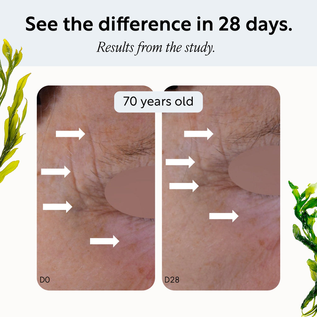 Overnight Eye Treatment with Retinol Exosomes